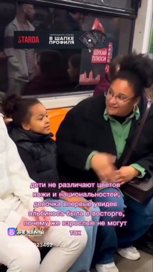 Девочка впервые увидела альбиноса☺️🤗