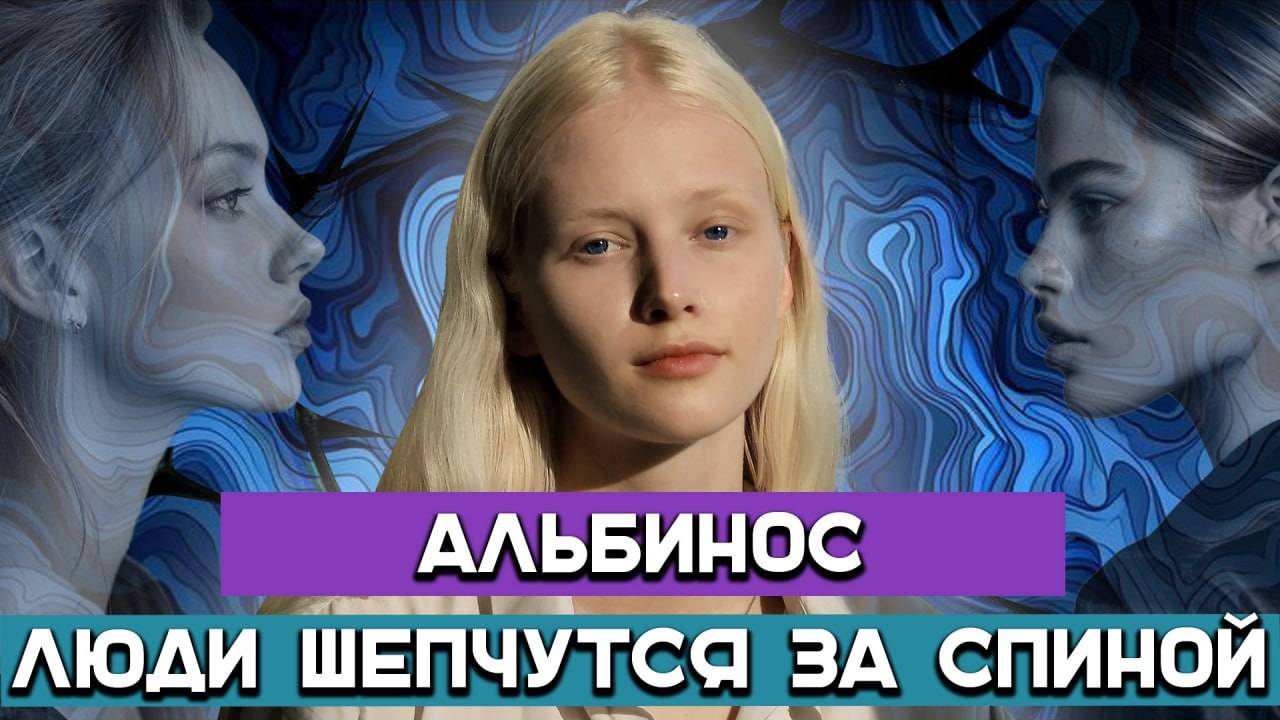 Жизнь с альбинизмом: быть не как все смотреть онлайн