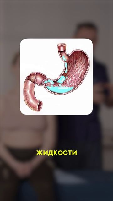 ПОЧЕМУ происходят ЗАПОРЫ? смотреть онлайн