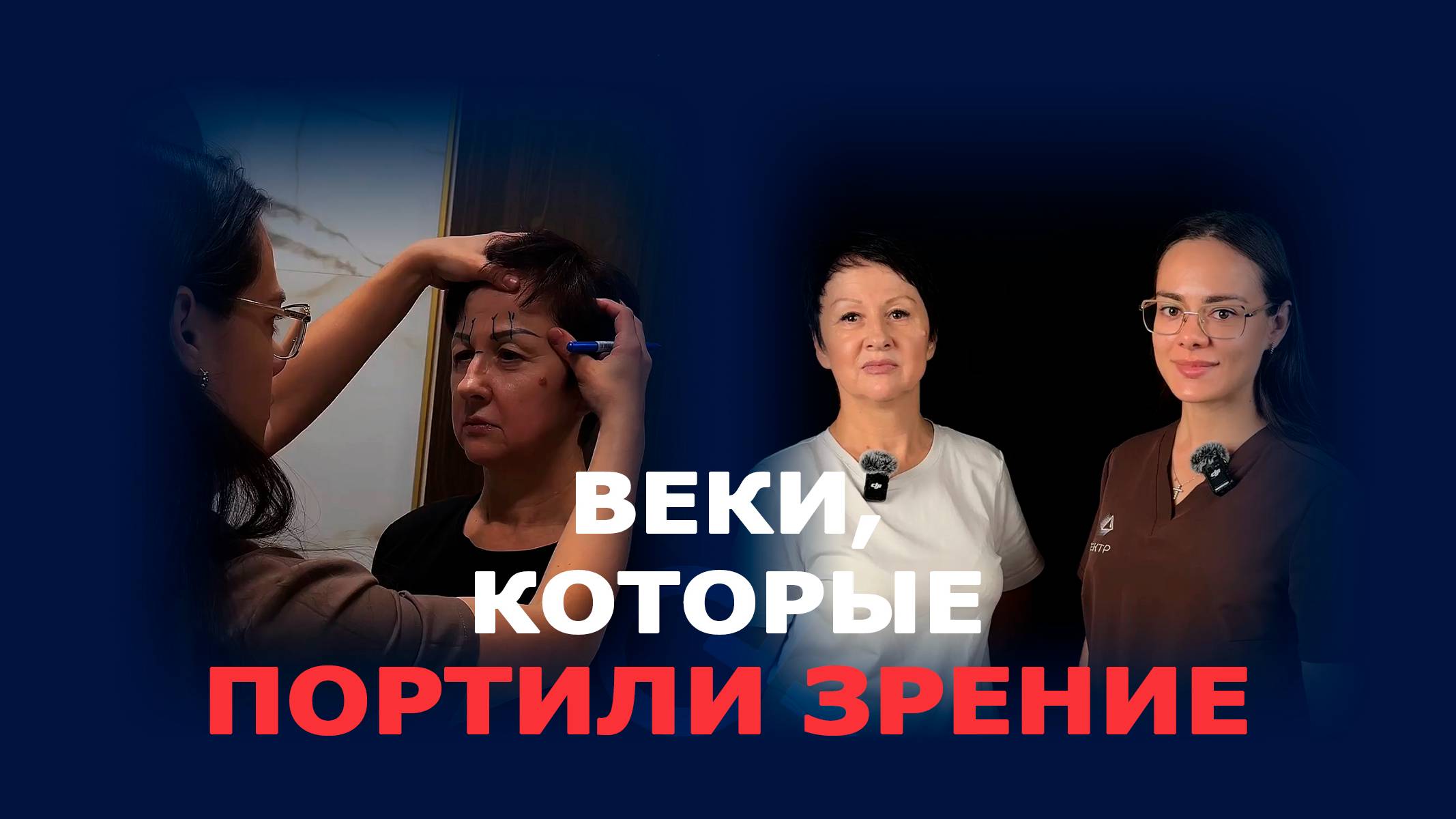 Лифтинг лба, висков и пластика верхних век: история Людмилы смотреть онлайн