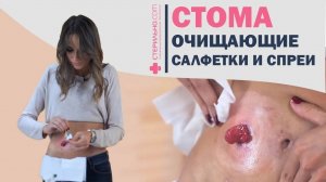 Как правильно очистить кожу вокруг стомы?  | Стерильно.com 4К
