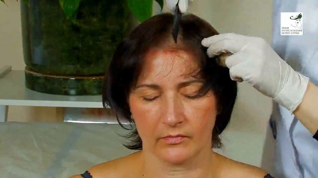 Мезотерапия в трихологии + теория смотреть онлайн