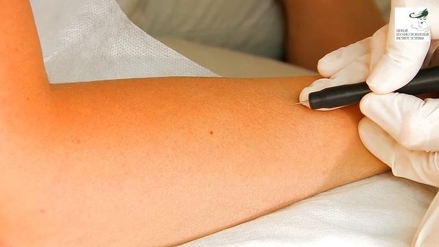 Электроэпиляция (Палатай М.А.) смотреть онлайн