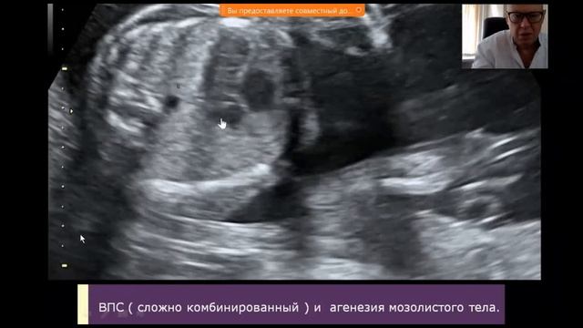 1 18092025. УЗИ акушерство и гинекология. Маммография смотреть онлайн