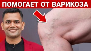 ЛЕЧЕНИЕ ВАРИКОЗНОГО РАСШИРЕНИЯ ВЕН | ПОМОГАЕТ ОТ ВАРИКОЗНОГО РАСШИРЕНИЯ ВЕН.