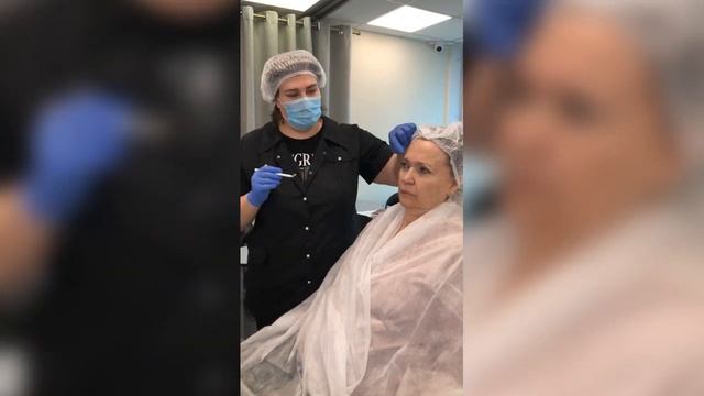 Ботулотоксин. Верхняя треть смотреть онлайн