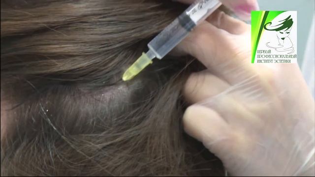 Мезотерапия в трихологии смотреть онлайн