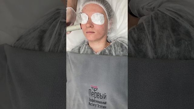 Лазерная биоревитализация смотреть онлайн