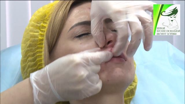 Контурная пластика губ смотреть онлайн