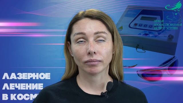 Отзыв модели на блефаропластику лазером смотреть онлайн