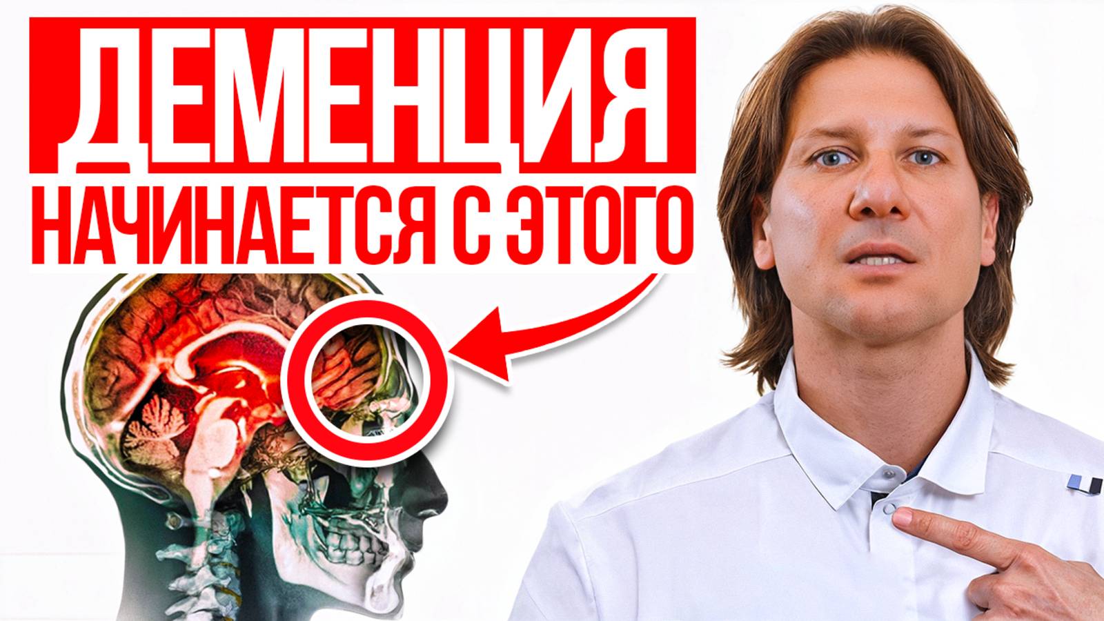 10 предупреждающих знаков, что у вас уже есть деменция! Как остановить деменцию? смотреть онлайн