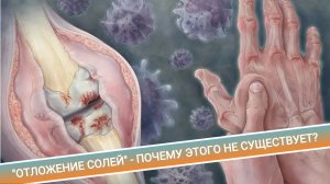 «ОТЛОЖЕНИЕ СОЛЕЙ» - ПОЧЕМУ ЭТОГО НЕ СУЩЕСТВУЕТ?