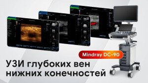 Мастер-класс по УЗИ глубоких вен нижних конечностей на Mindray DC-90