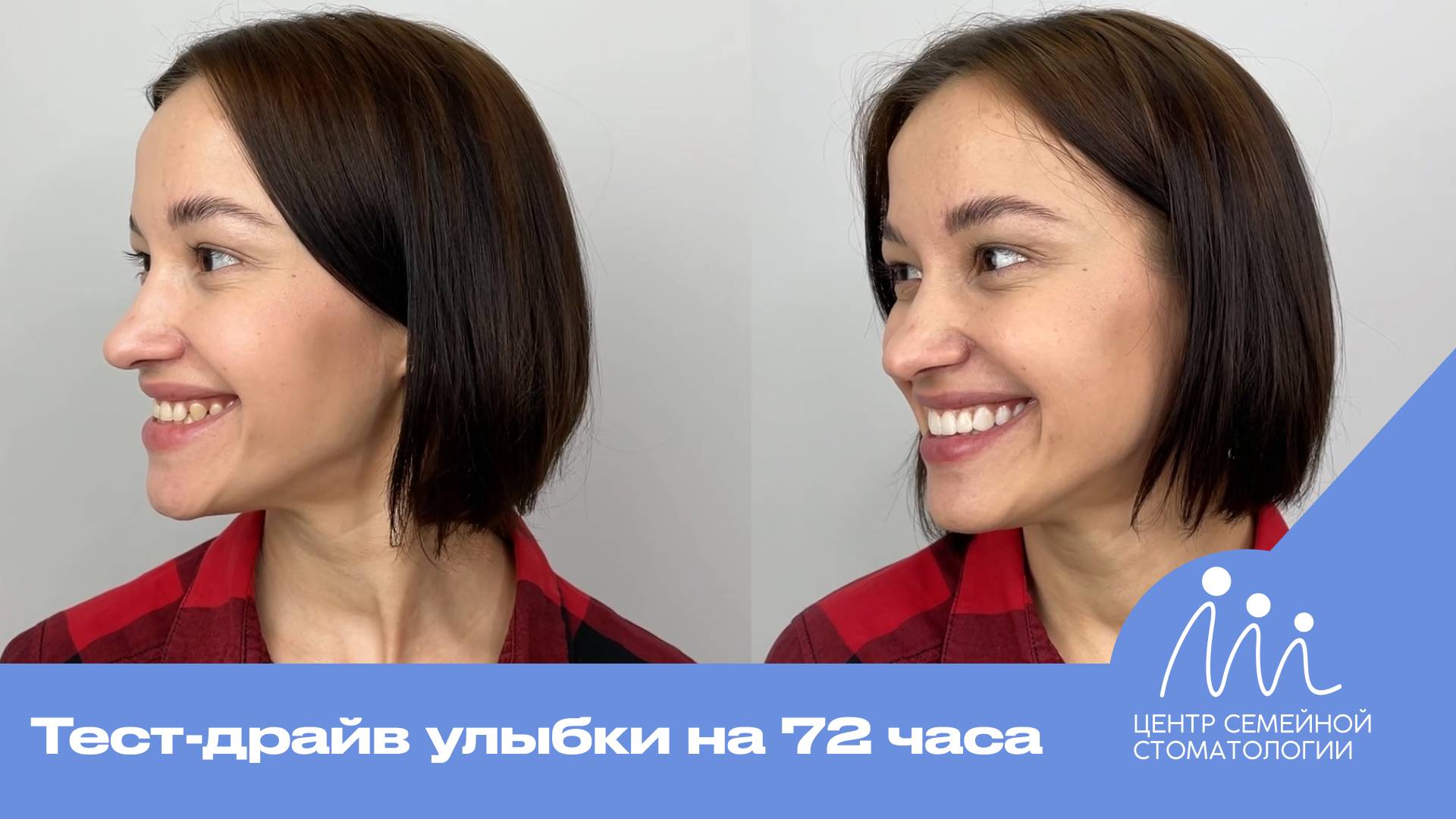 Тест-драйв новой улыбки за 72 часа | Примерка виниров в Центре Семейной Стоматологии