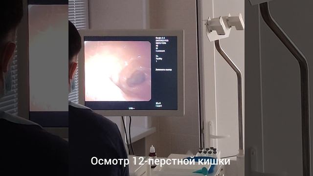 Сколько длится ФГДС? Реальное исследование без наркоза. смотреть онлайн