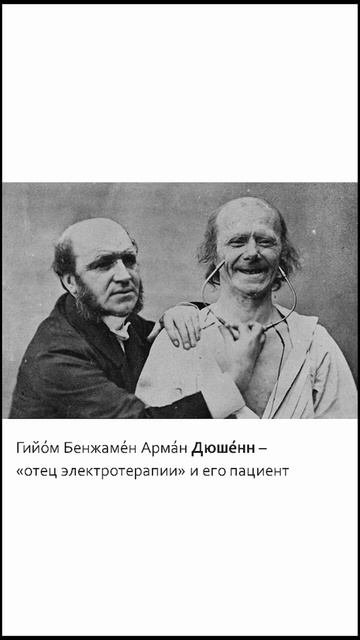 #улыбка #статистика #страдания #якавюрич #shorts #smile #кусочеклекции смотреть онлайн