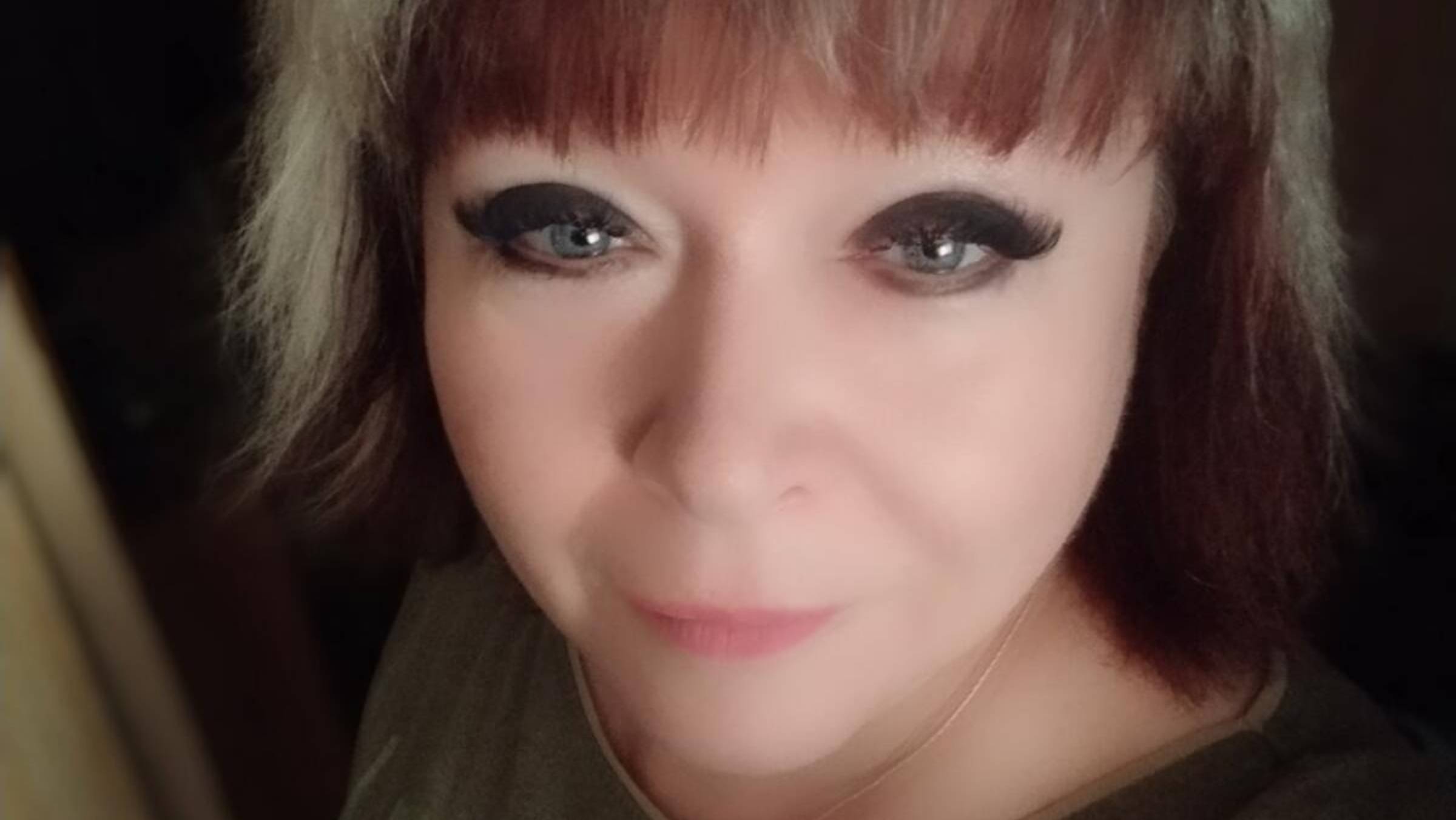 Велгия. Результаты и ощущения на 13 день после двух уколов.