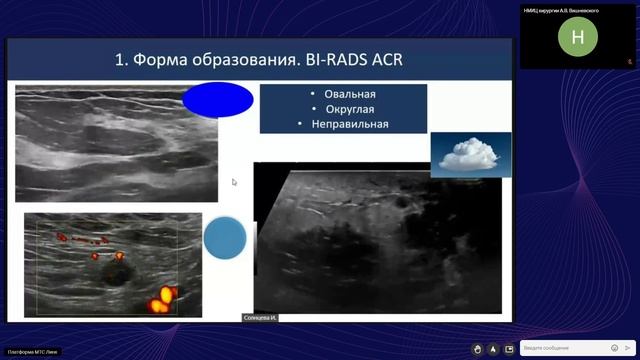 2 УЗИ BIRADS смотреть онлайн
