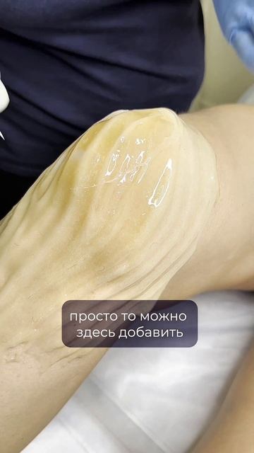 Как избежать залипания при шугаринге коленей, рассказывает технолог центра эпиляции Софт Эпил