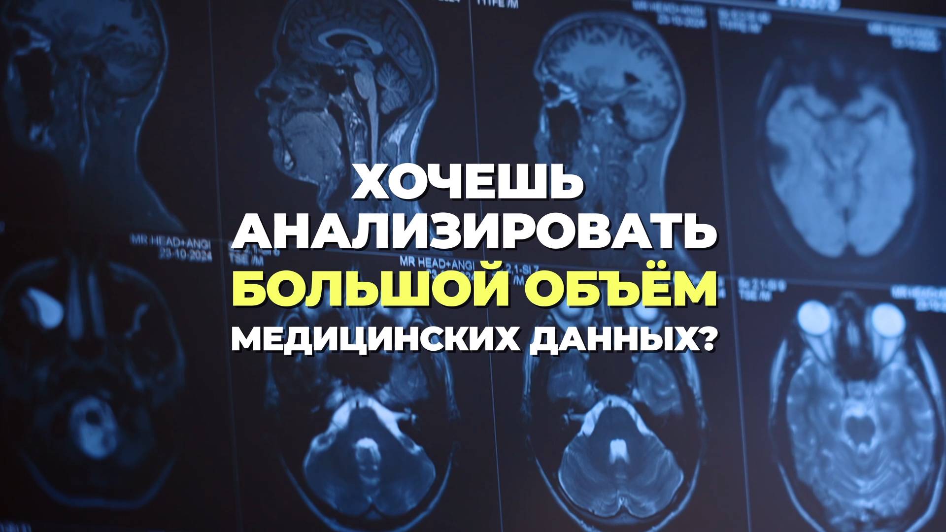 Программа «Цифровая медицина» смотреть онлайн