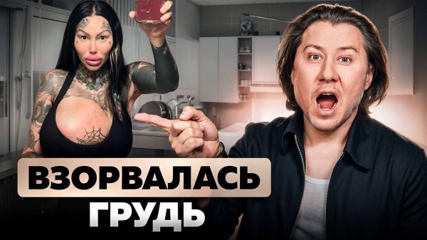 Почему ВЗОРВАЛСЯ огромный имплант в груди? Жертва пластики Мария Магдалена