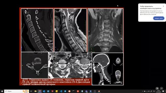 22092025 Рентген неотложка смотреть онлайн