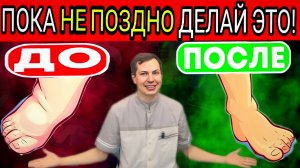 Сосудистая гимнастика от ОТЕКОВ / Простые упражнения от УСТАЛОСТИ и при ВАРИКОЗЕ