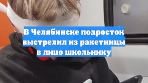 В Челябинске подросток выстрелил из ракетницы в лицо школьнику