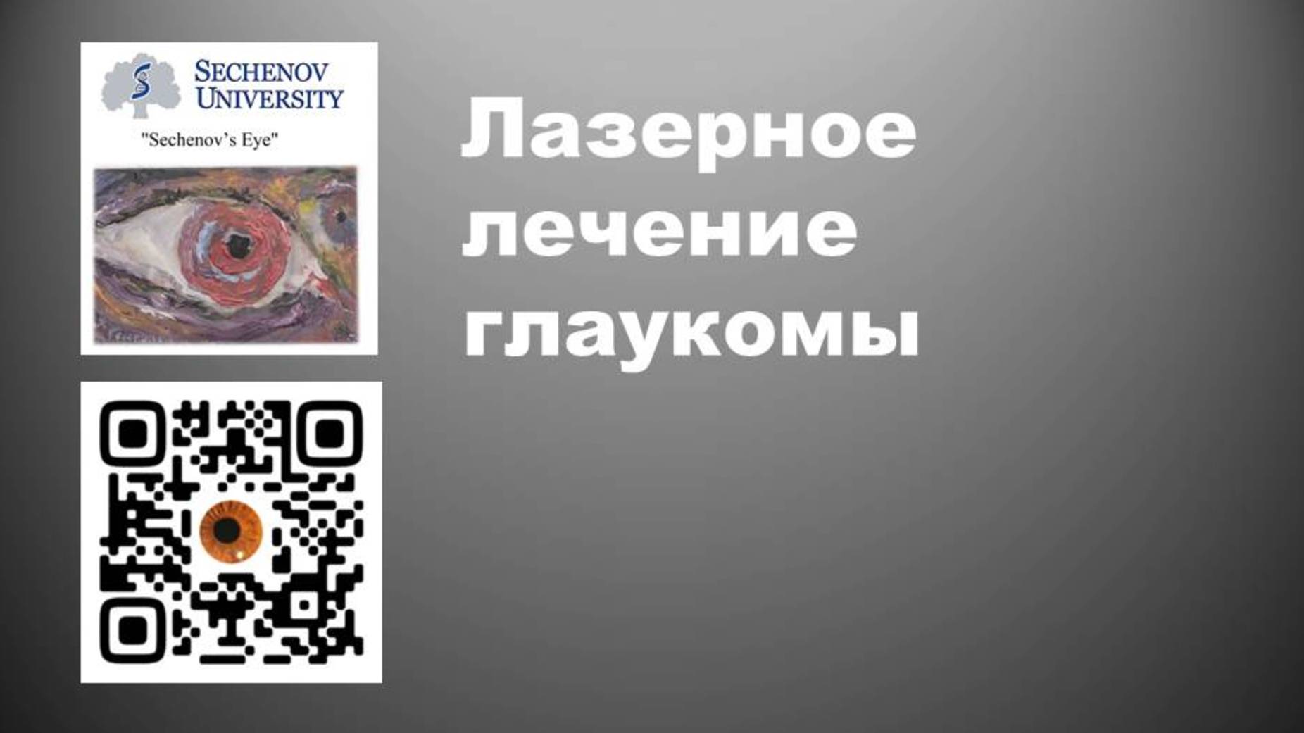 Лазерное лечение глаукомы_D