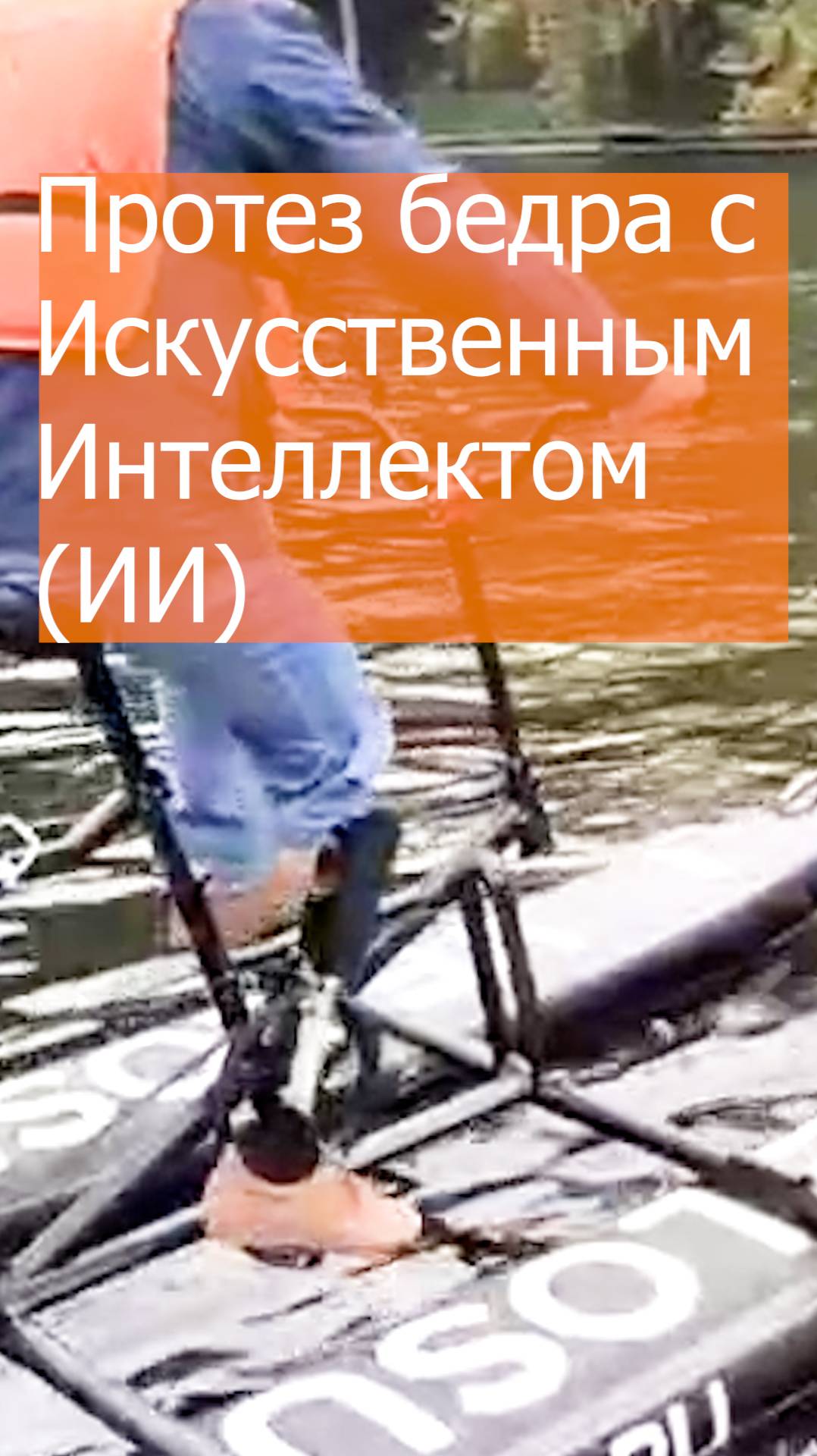 Протез бедра с Искусственным Интеллектом (ИИ) смотреть онлайн