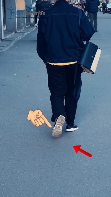 Походка и внутренний завал стопы смотреть онлайн