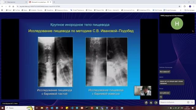 4 Рентген Пищевод смотреть онлайн