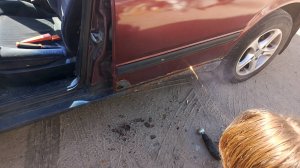 Лазерная эпиляция.