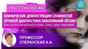 Профессор Сперанская А.А.: Цикл «Рентгенологический детектив». Серия 2: Дама с камелиями