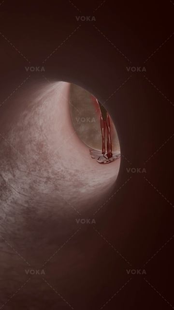 Что такое травматическая перфорация барабанной перепонки и как она влияет на слух?Анатомия уха в 3D