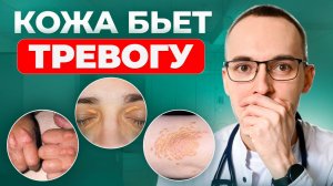 ТАК КОЖА КРИЧИТ О ВЫСОКОМ ХОЛЕСТЕРИНЕ. Срочно заметь ЭТО!