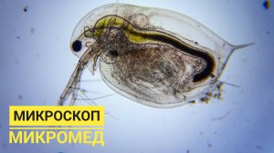 Простейшие в воде аквариума под микроскопом Микромед. Амеба, инфузория, нематода, коловратка