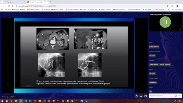 5 25092025 Рентгенология боевых ранений смотреть онлайн