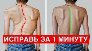 Эти УПРАЖНЕНИЯ Убирают Детский Сколиоз ЗА 1 МИНУТУ!
