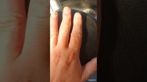 Вылечил псориаз. Часть 1