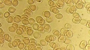 Голодание правда, о которой не расскажут