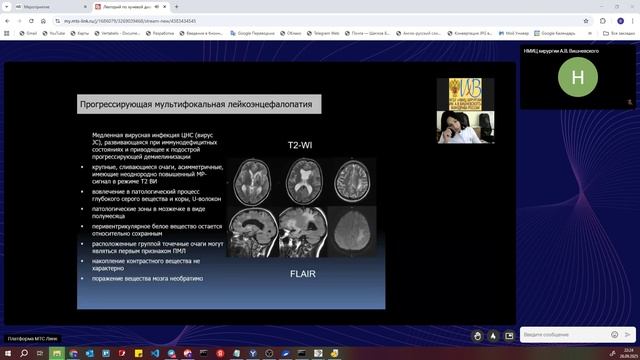 7 Инсульты смотреть онлайн