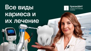 Кариес - симптомы, виды, как выглядит. Как лечить кариес без сверления? | ПрезиДЕНТ 💚