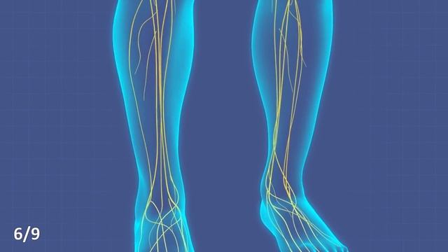 7 железных причин есть чернослив каждый день (вот это эффект) смотреть онлайн