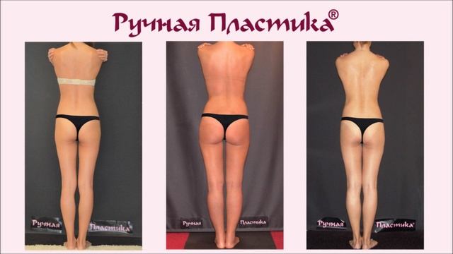 Ручная Пластика