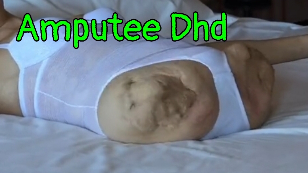 Amputee Dhd смотреть онлайн
