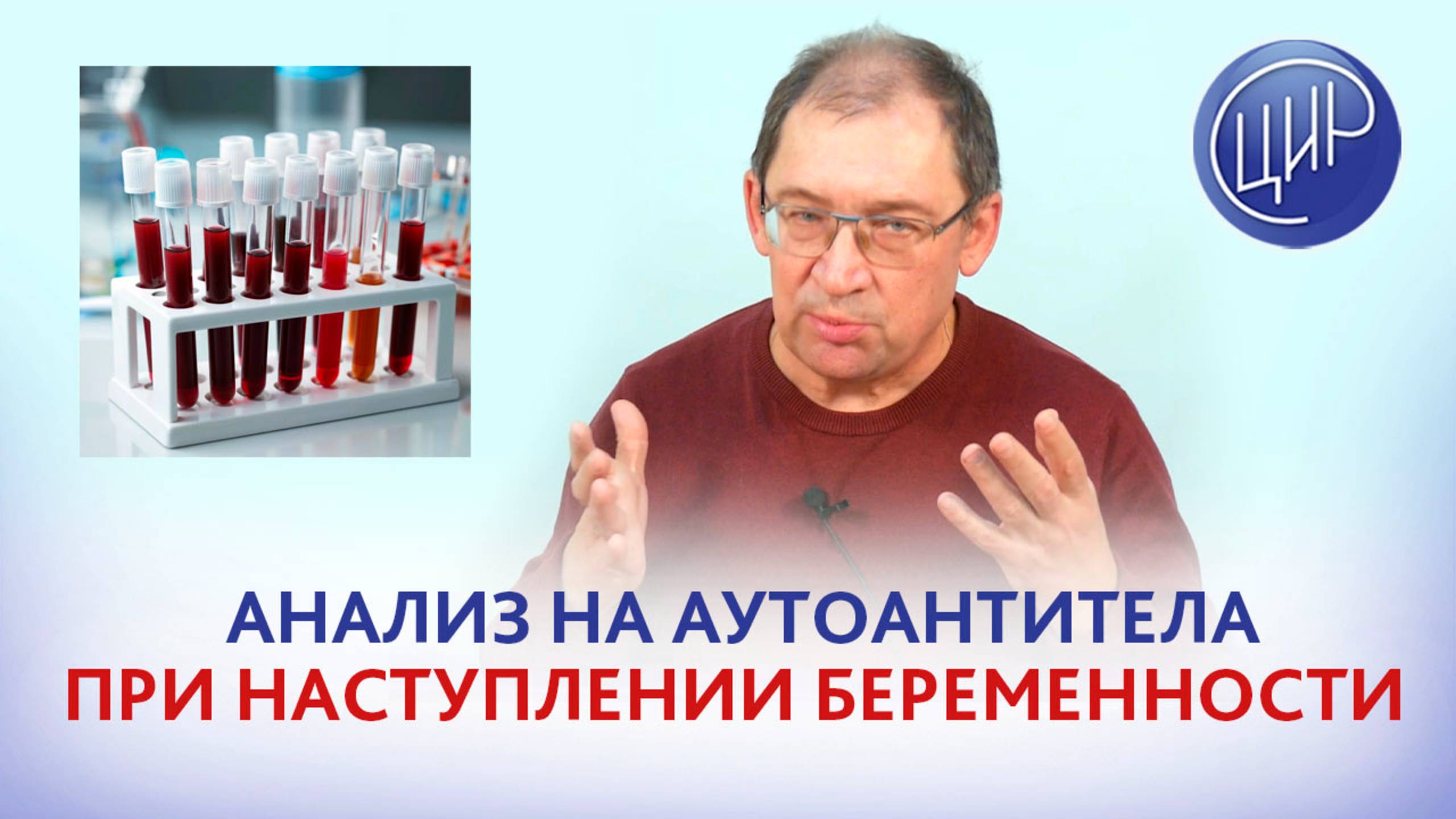 Почему надо делать анализ на аутоантитела при наступлении беременности. К.м.н. Игорь Иванович Гузов. смотреть онлайн