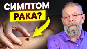 💡 Способ заметить опухоль задолго до онкомаркёров и биопсии