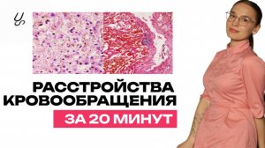 Расстройства кровообращения за 20 минут