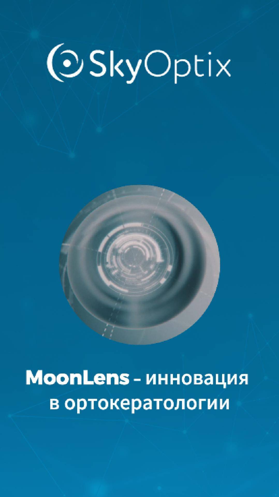 MoonLens – первые ортолинзы комбинированного дизайна